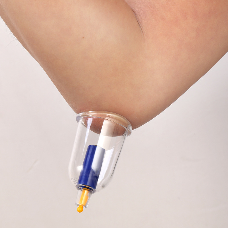 Vacuum Cupping Device